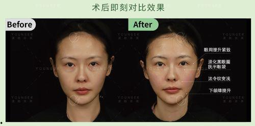 明星同款抗衰,揭秘逆龄护肤之道